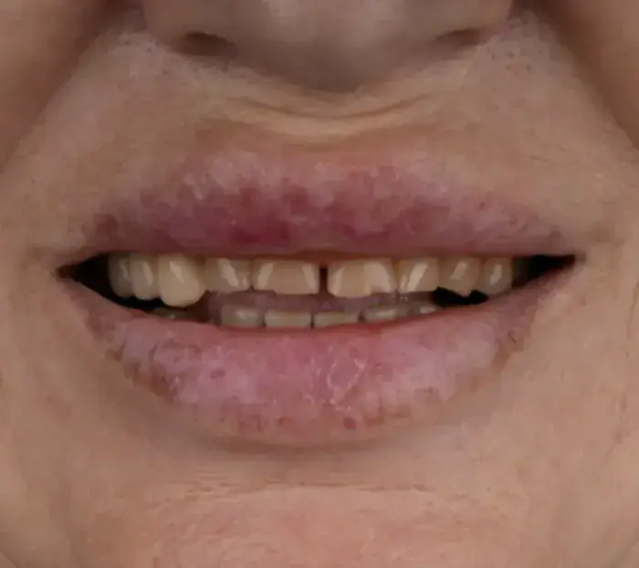 Smile transformation 8 — before