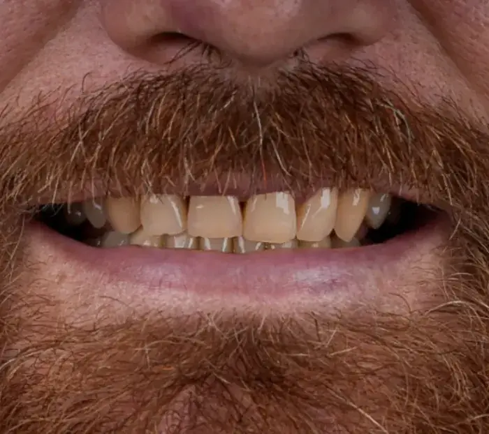 Smile transformation 6 — before