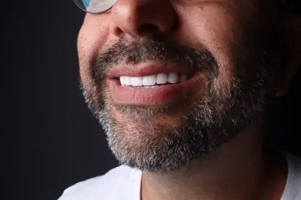 Zirconia Crowns — close-up 2