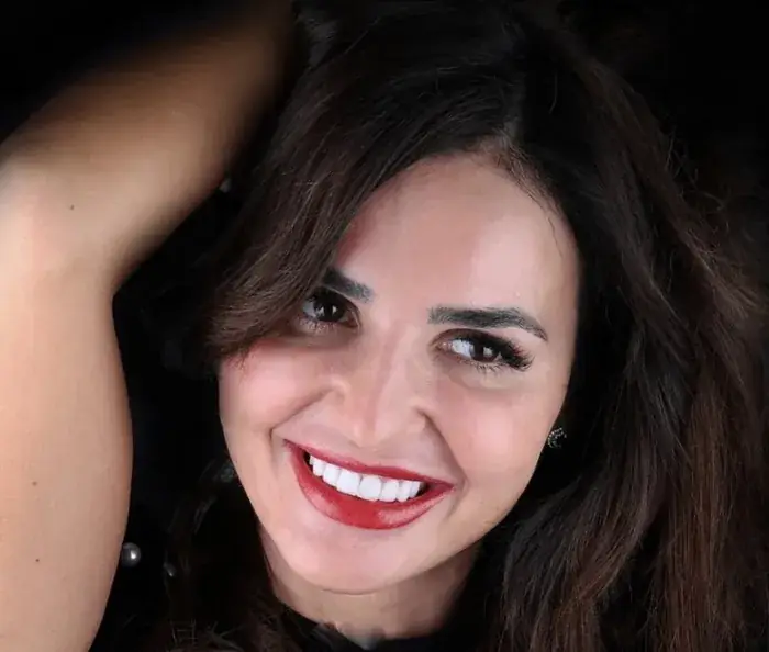 Veneers — results